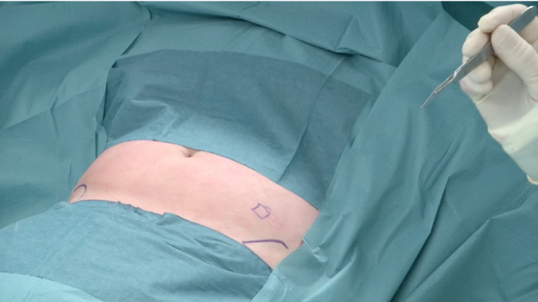 MEDICINA RIGENERATIVA